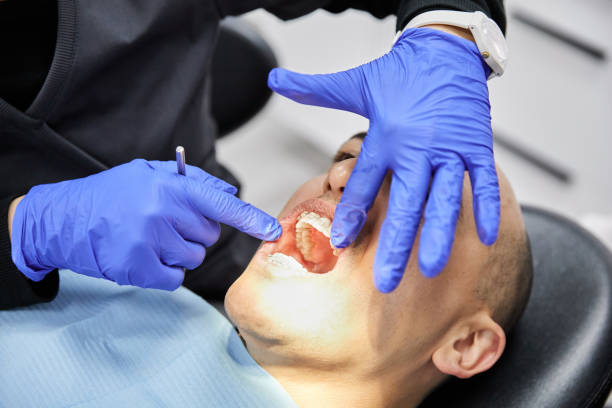 Best Emergency Tooth Extraction in Lawrenceburg, IN
