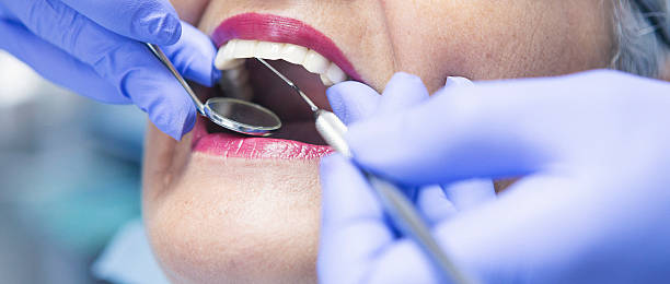 Best Urgent Care for Lost Fillings or Crowns in Lawrenceburg, IN